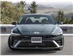 2025 Hyundai Elantra N Line Ultimate (Stk: SE921568) in Abbotsford - Image 2 of 21