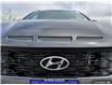 2022 Hyundai Kona 1.6T N Line w/Ultimate Package (Stk: 20U2037) in Innisfil - Image 9 of 23