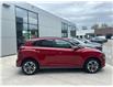 2022 Hyundai Kona Electric Ultimate (Stk: H9836A) in Toronto - Image 4 of 21