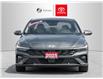 2025 Hyundai Elantra Luxury (Stk: 353832) in Aurora - Image 2 of 24