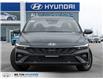 2025 Hyundai Elantra Preferred (Stk: 007397) in Milton - Image 2 of 22