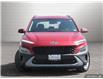 2022 Hyundai Kona 2.0L Preferred (Stk: U802806-OC) in Orangeville - Image 2 of 29