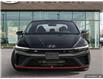 2025 Hyundai Elantra N Base (Stk: 127861) in London - Image 2 of 21