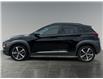 2021 Hyundai Kona 1.6T Ultimate (Stk: P40117) in Saskatoon - Image 2 of 15