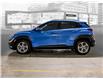 2022 Hyundai Kona 2.0L Preferred (Stk: 25819A) in Toronto - Image 5 of 23