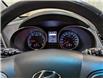 2016 Hyundai Santa Fe Sport 2.4 Luxury (Stk: 25051630) in Calgary - Image 21 of 30