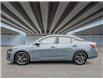 2025 Nissan Sentra SV (Stk: 25205) in Toronto - Image 3 of 23