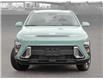 2025 Hyundai Kona 2.0L Preferred w/Trend Package (Stk: 25894) in Toronto - Image 2 of 19