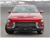 2025 Hyundai Kona 2.0L Preferred w/Trend Package (Stk: 25901) in Toronto - Image 2 of 21