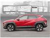 2025 Hyundai Kona 2.0L Preferred w/Trend Package (Stk: 25901) in Toronto - Image 3 of 21