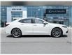 2017 Acura TLX Base (Stk: LN15134A) in Toronto - Image 5 of 28