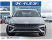 2025 Hyundai Elantra Preferred w/Tech Package (Stk: 028510) in Milton - Image 2 of 25
