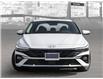 2025 Hyundai Elantra HEV Luxury (Stk: 25934) in Toronto - Image 2 of 22
