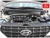 2024 Hyundai Venue Preferred (Stk: S11431A) in Hamilton - Image 11 of 30