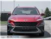 2022 Hyundai Kona 2.0L Preferred (Stk: 813345) in Milton - Image 2 of 23