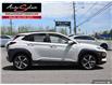 2018 Hyundai Kona 1.6T Ultimate (Stk: 1HTKW11) in Scarborough - Image 3 of 28