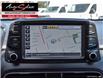2018 Hyundai Kona 1.6T Ultimate (Stk: 1HTKW11) in Scarborough - Image 17 of 28