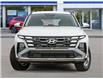 2025 Hyundai Tucson Preferred (Stk: 261598) in Aurora - Image 2 of 23