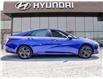 2021 Hyundai Elantra Preferred (Stk: U09160) in North York - Image 3 of 14
