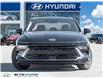2026 Hyundai Sonata Hybrid Preferred-Trend (Stk: 137307) in Milton - Image 2 of 24
