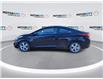 2014 Hyundai Elantra GL (Stk: 250409B) in Windsor - Image 5 of 18 2014 Hyundai Elantra GL (Stk: 250409B) in Windsor - Image 5 of 18