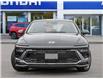 2026 Hyundai Sonata Preferred-Trend (Stk: 261706) in Aurora - Image 2 of 23 2026 Hyundai Sonata Preferred-Trend (Stk: 261706) in Aurora - Image 2 of 23