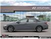 2025 Hyundai Elantra Preferred (Stk: U088176) in Brooklin - Image 3 of 23