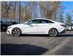 2025 Hyundai Elantra  (Stk: R25811A) in Brockville - Image 4 of 25