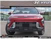 2026 Hyundai Kona 2.0L Preferred (Stk: U389779) in Brooklin - Image 2 of 26