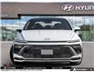 2025 Hyundai Sonata Preferred-Trend (Stk: A499127) in Brooklin - Image 2 of 24