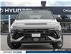 2025 Hyundai Kona 1.6T N Line w/Two-Tone Roof (Stk: ONH307990) in Whitby - Image 2 of 25