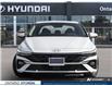 2025 Hyundai Elantra Luxury (Stk: ONH885994) in Whitby - Image 2 of 25