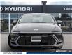 2025 Hyundai Sonata N-Line Ultimate (Stk: 7-1022) in Whitby - Image 2 of 23