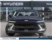 2026 Hyundai Sonata Hybrid Preferred-Trend (Stk: 7-1472) in Whitby - Image 2 of 25