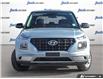 2021 Hyundai Venue Essential w/Two-Tone (Stk: 99388) in London - Image 2 of 25