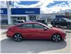 2021 Hyundai Elantra Ultimate (Stk: 261711A) in Aurora - Image 2 of 16