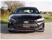 2020 Hyundai Veloster Turbo w/Sandstorm Leather (Stk: 30390) in Surrey - Image 2 of 23