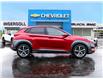 2019 Hyundai Kona 1.6T Ultimate (Stk: 26064A) in Ingersoll - Image 3 of 27