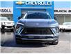 2026 Buick Envision Sport Touring (Stk: 26058) in Ingersoll - Image 2 of 23
