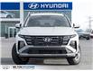 2026 Hyundai Tucson Preferred (Stk: 033694) in Milton - Image 2 of 22