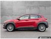 2020 Hyundai Kona 2.0L Preferred (Stk: 25T160A) in Williams Lake - Image 3 of 29