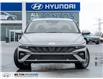 2026 Hyundai Elantra Preferred (Stk: 124884) in Milton - Image 2 of 22
