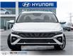 2026 Hyundai Elantra Preferred (Stk: 124888) in Milton - Image 2 of 26