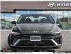 2026 Hyundai Elantra N-Line Ultimate (Stk: U097906) in Brooklin - Image 2 of 23