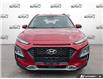 2020 Hyundai Kona 2.0L Luxury (Stk: R532A) in Grimsby - Image 2 of 24