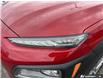 2020 Hyundai Kona 2.0L Luxury (Stk: R532A) in Grimsby - Image 8 of 24