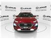 2018 Hyundai Kona  (Stk: 14U7079) in Markham - Image 4 of 32