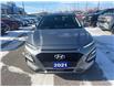 2021 Hyundai Kona 2.0L Luxury (Stk: 251223A) in Port Hope - Image 2 of 20