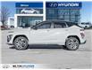 2026 Hyundai Kona 1.6T N Line w/Two-Tone Roof (Stk: 397877) in Milton - Image 3 of 28