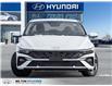2026 Hyundai Elantra Preferred (Stk: 102146) in Milton - Image 2 of 25